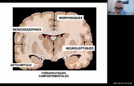 PACES -UE 7- Morgan Le Guen