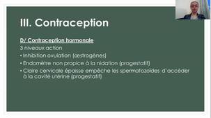Etapes de la vie génitale femme - 4/5 Contraception
