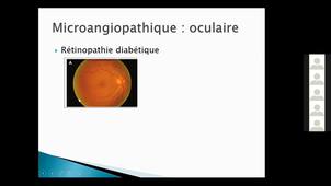 UE 2.7 - S4 : ENDOCRINOLOGIE - Diabète & Hypothyroïdie par L. Foussier