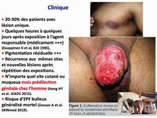 DU Androdermatologie - Erythème Pigmenté Fixe - O. Chosidow