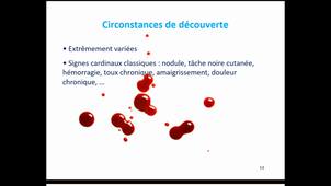 Quand et comment fait-on un diagnostic de cancer ?