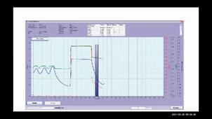 UE 2.7 S4 Insuffisance respiratoire - Notion d'Explorations Fonctionnelles Respiratoire - EFR - Fibroscopie bronchique