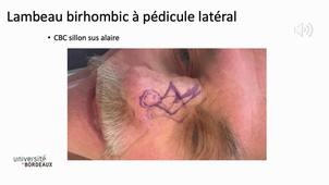 Amici Chirurgie dermato androïde